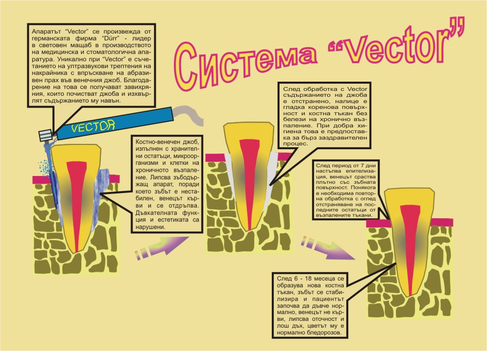 Начин на действие на системата Вектор
